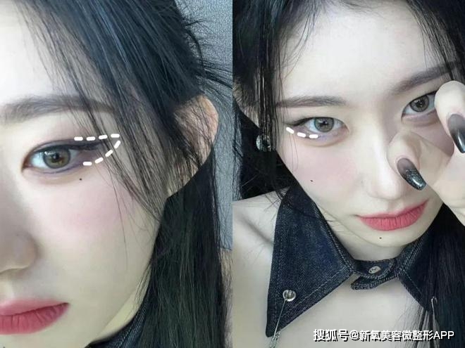 额头窄颧骨高的女明星_韩素希高颧骨审美_韩素希骨相美女