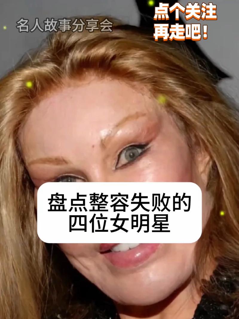 好莱坞整容女明星_好莱坞整容_整过容的好莱坞女星